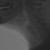 170332.png